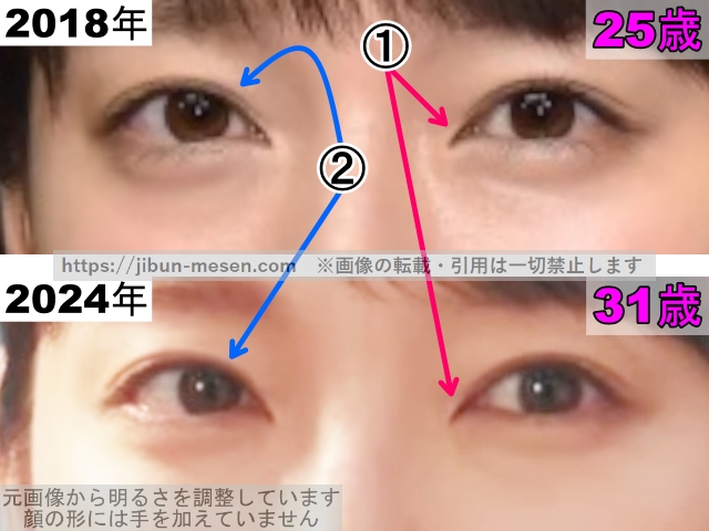 吉岡里帆の目の整形検証2018年〜2024年（拡大）の画像