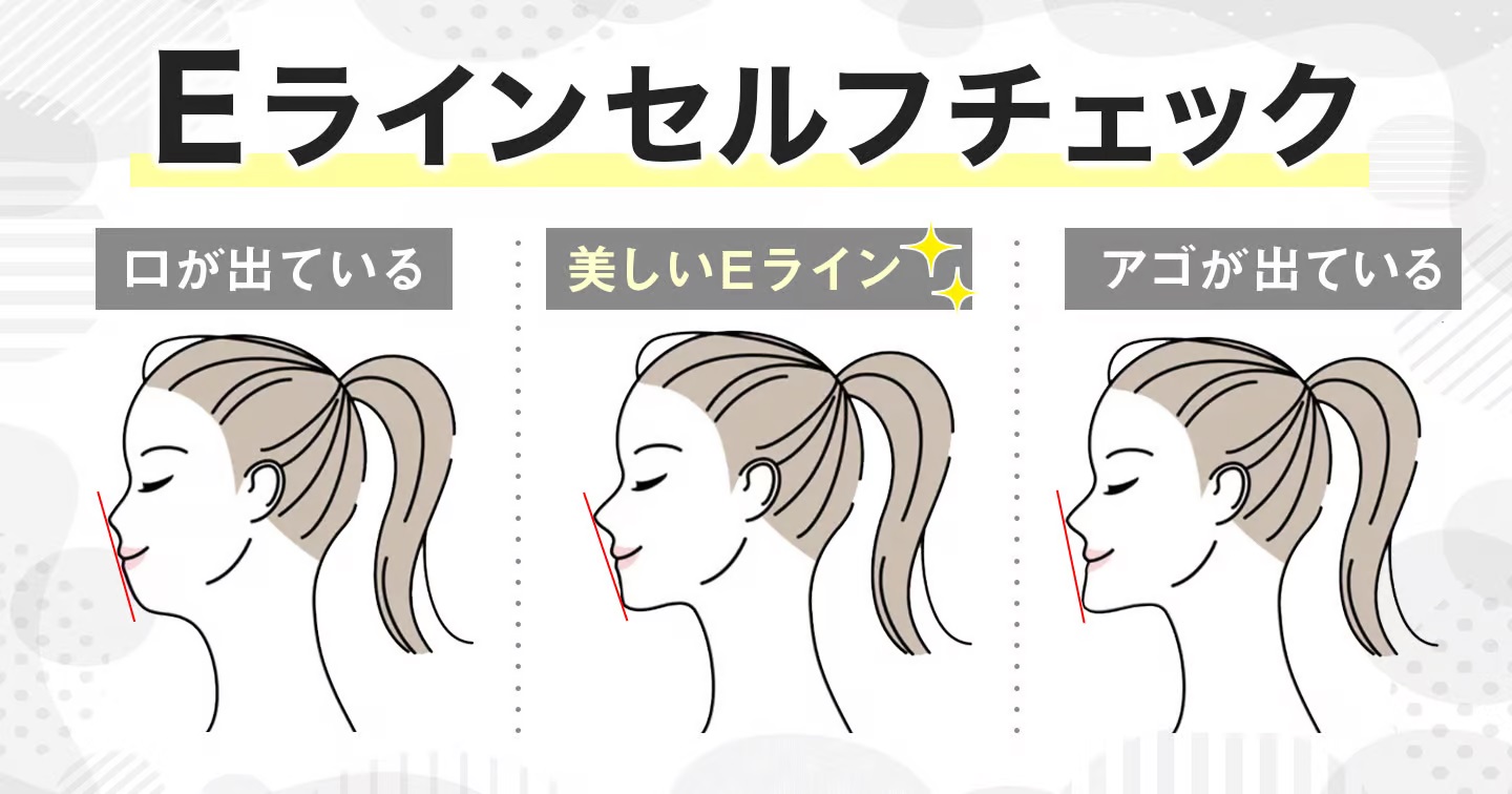 Eラインセルフチェック[横顔で鼻とアゴに接するライン]口が出ている 美しいEライン[口・アゴが出ていない] アゴが出ている