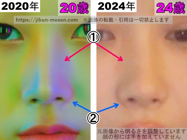 ジゼルの鼻の整形検証2020年〜2024年（拡大）の画像