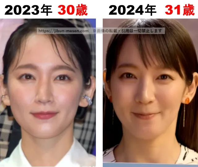 吉岡里帆の整形検証2023年〜2024年
