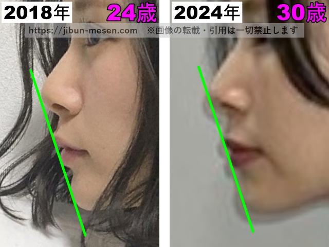 朝日奈央の唇の立体感の比較2018年〜2024年の画像