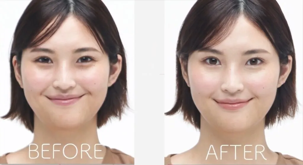 涙袋を目立たなくさせるメイクのビフォーアフター