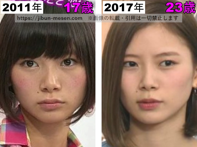 朝日奈央の唇の整形検証2011年〜2017年（閉口）の画像