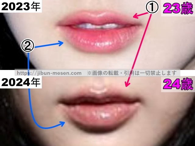 ジゼルの唇の整形検証2023年〜2024年（拡大）の画像