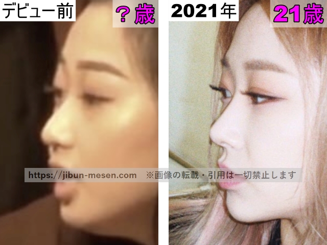 ジゼルの鼻の整形検証デビュー前〜2021年の画像