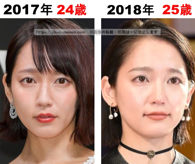 吉岡里帆の整形検証2017年〜2018年の画像