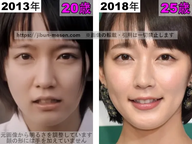 吉岡里帆の鼻の整形検証2013年〜2018年