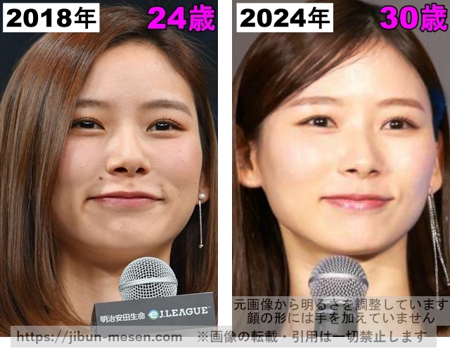 朝日奈央の唇の整形検証2018年～2024年の画像