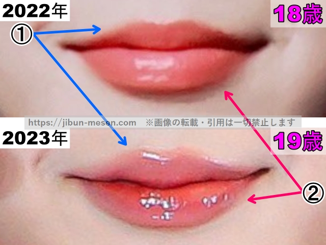 ヒカルの唇の整形検証2022年〜2023年（拡大）の画像