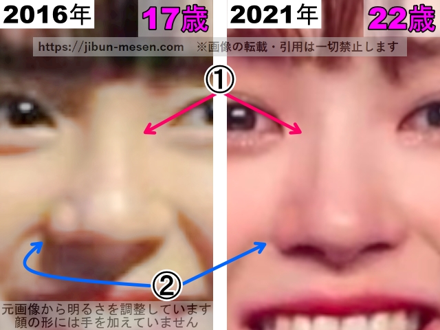 マシロの鼻の整形検証2016年〜2021年（拡大）の画像