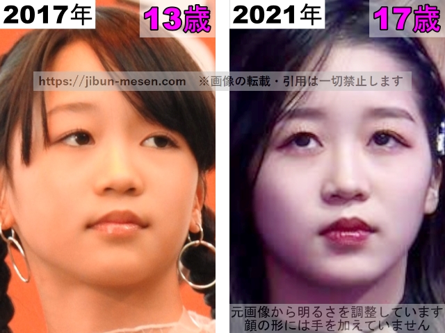 ヒカルの唇の整形検証2017年〜2021年の画像
