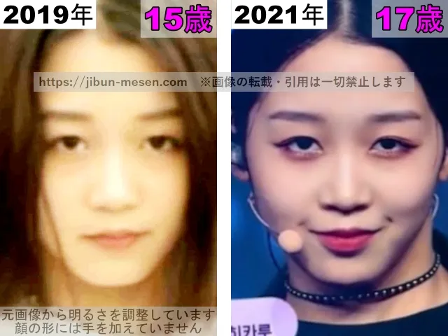 ヒカルの鼻の整形検証2019年〜2021年