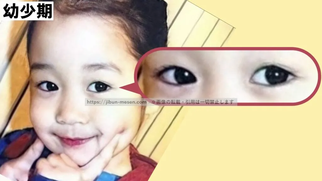 幼少期のヒカルのまぶた