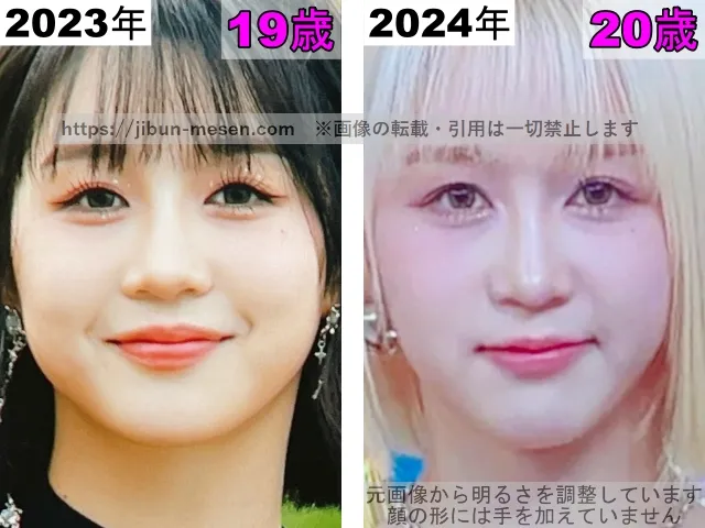 ヒカルの目の整形検証2023年〜2024年