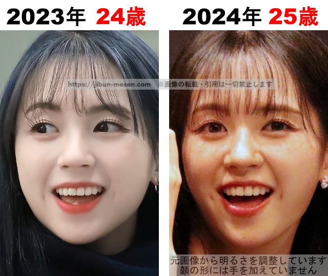 マシロの整形検証2023年〜2024年の画像