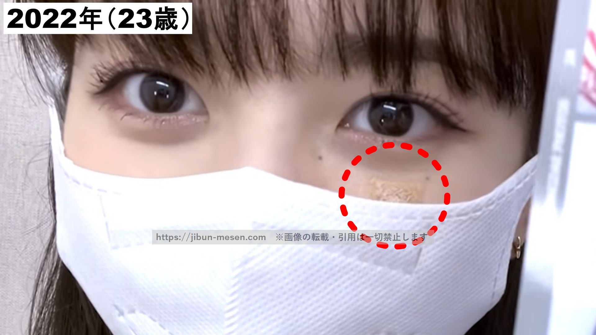 頬にテープを貼っているマシロの画像