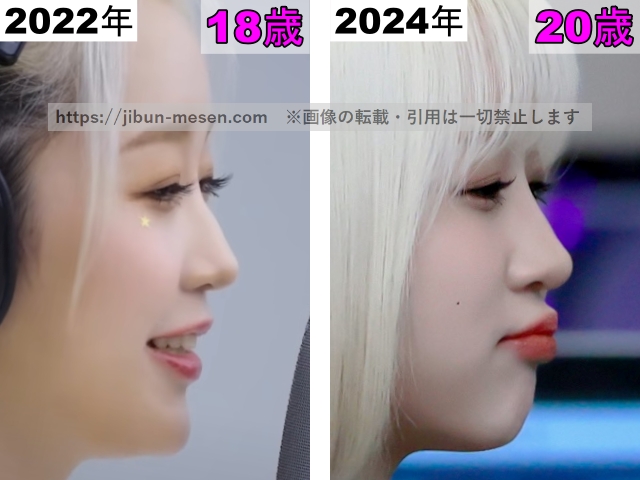 ヒカルの鼻の整形検証2022年〜2024年（横顔）の画像