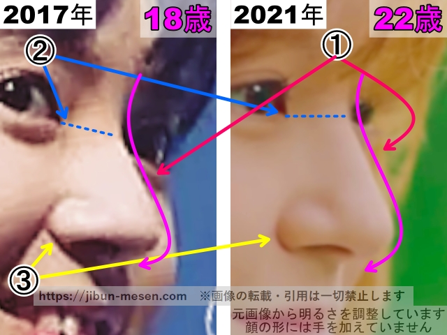 マシロの鼻の整形検証2017年〜2021年（拡大）の画像