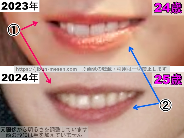 マシロの唇の整形検証2023年〜2024年（拡大）の画像