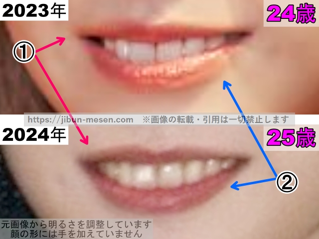 マシロの唇の整形検証2023年〜2024年(拡大)の画像