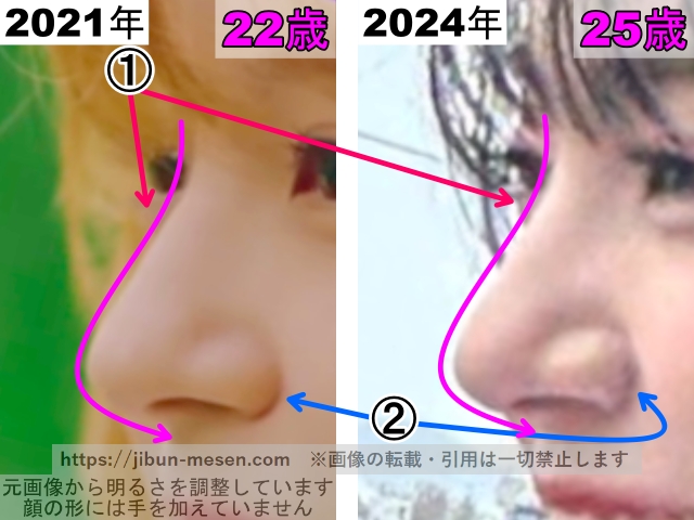 マシロの鼻の整形検証2021年〜2024年（拡大）の画像
