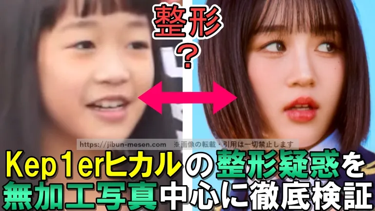 Kep1erヒカルの整形疑惑を無加工写真中心に徹底検証