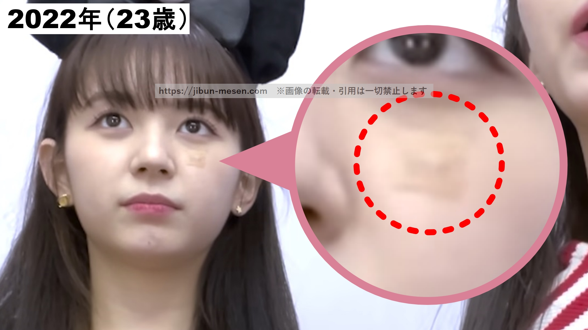 サージカルテープを頬に貼っているマシロの画像