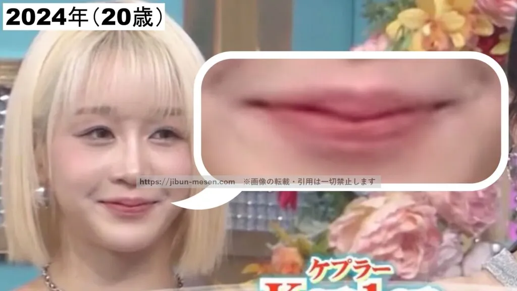 2024年のヒカルの唇の厚さ