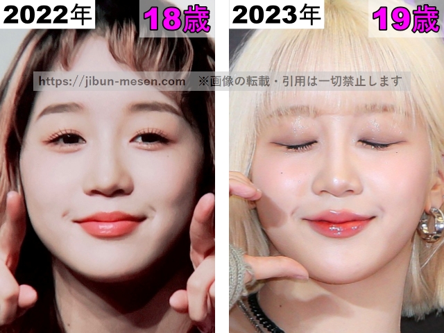 ヒカルの唇の整形検証2022年〜2023年の画像