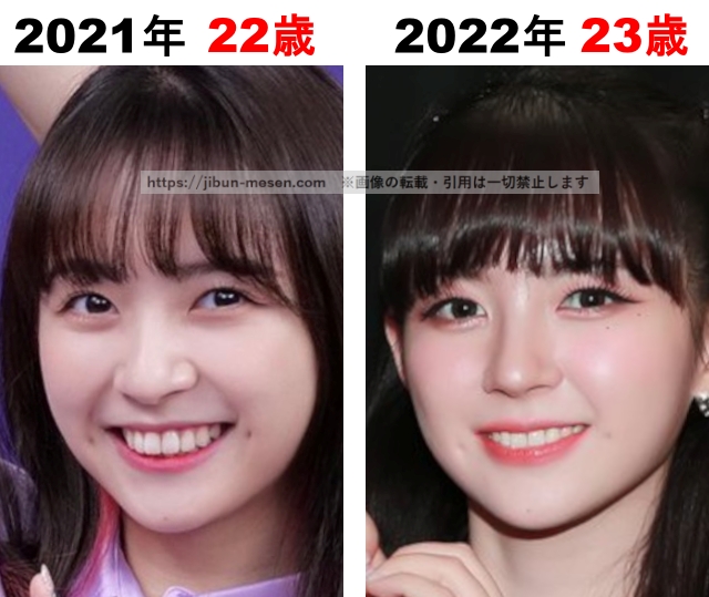 マシロの整形検証2021年〜2022年の画像