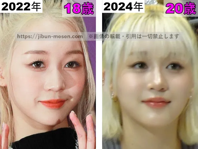 ヒカルの鼻の整形検証2022年〜2024年