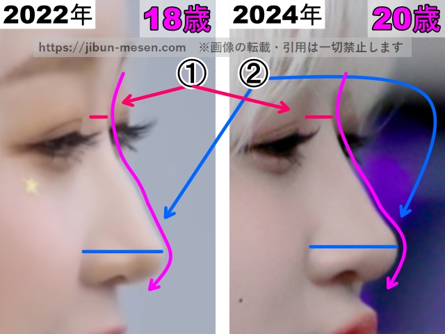 ヒカルの鼻の整形検証2022年～2024年（横顔・拡大）の画像