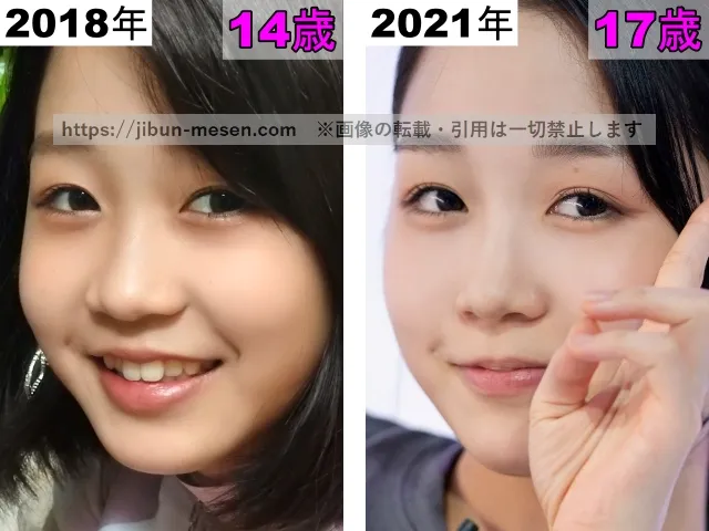 ヒカルの目の整形検証2018年〜2021年