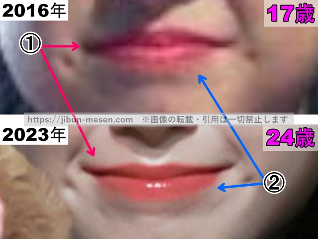 マシロの唇の整形検証2016年〜2023年（拡大）の画像