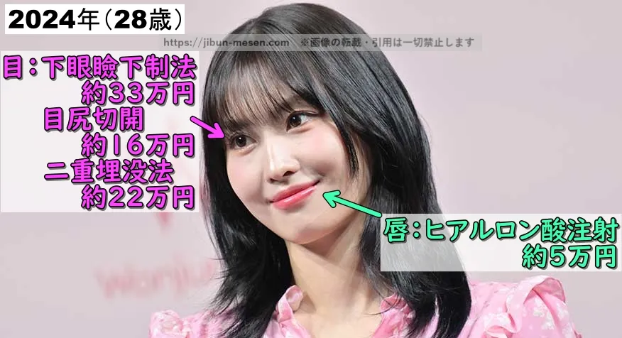TWICEモモが整形した箇所とその費用