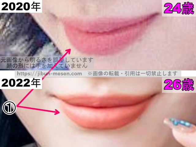 TWICEモモの唇の整形検証2020年〜2022年(拡大)の画像