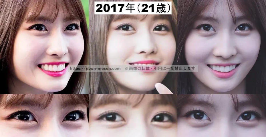 TWICEモモの二重まぶた(2017年)