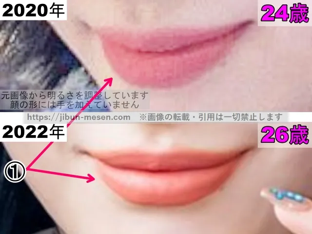 TWICEモモの唇の整形検証2020年〜2022年（拡大）
