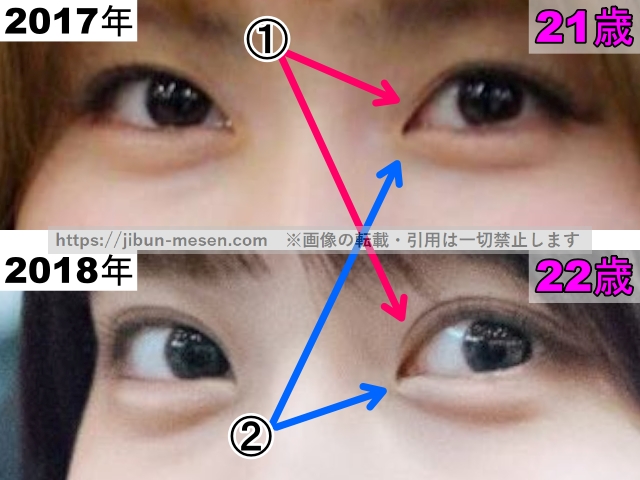 TWICEモモの目の整形検証2017年〜2018年(拡大)の画像