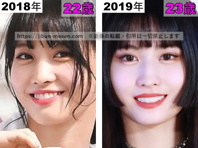 TWICEモモの唇の整形検証2018年〜2019年（開口）