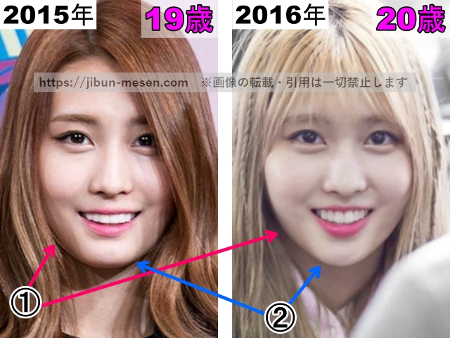 TWICEモモの輪郭の整形検証2015年〜2016年（拡大）の画像