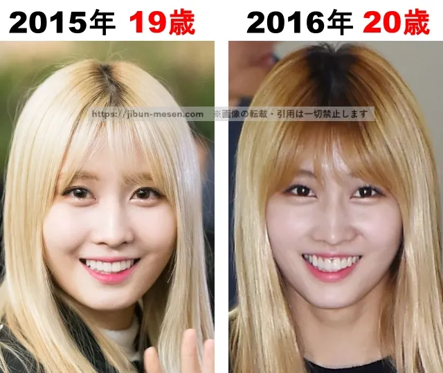 TWICEモモの整形検証2015年〜2016年