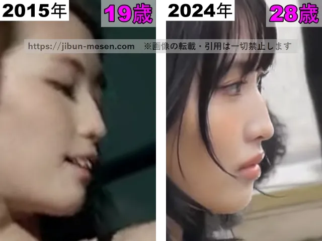 TWICEモモの鼻の整形検証2015年〜2024年（拡大）