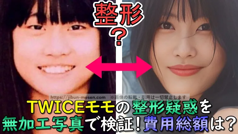 TWICEモモの整形疑惑を無加工写真で検証！費用総額は？