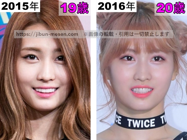 TWICEモモのエラの整形検証2015年〜2016年の画像