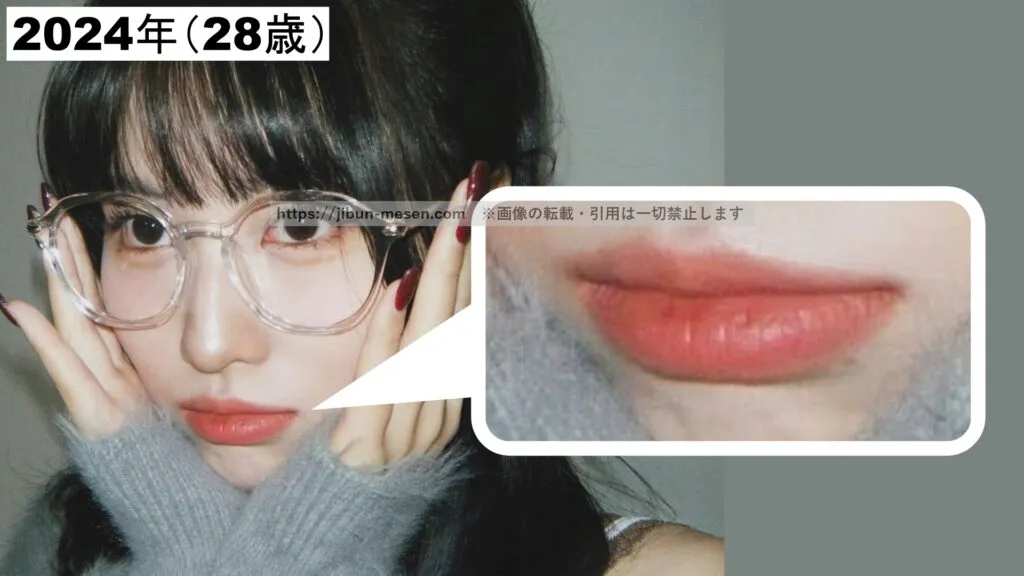 ヒアルロン酸注射で唇を整形したと思われるTWICEモモ