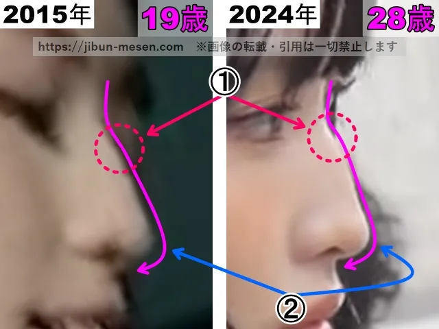 TWICEモモの鼻の整形検証2015年〜2024年（横顔・拡大）