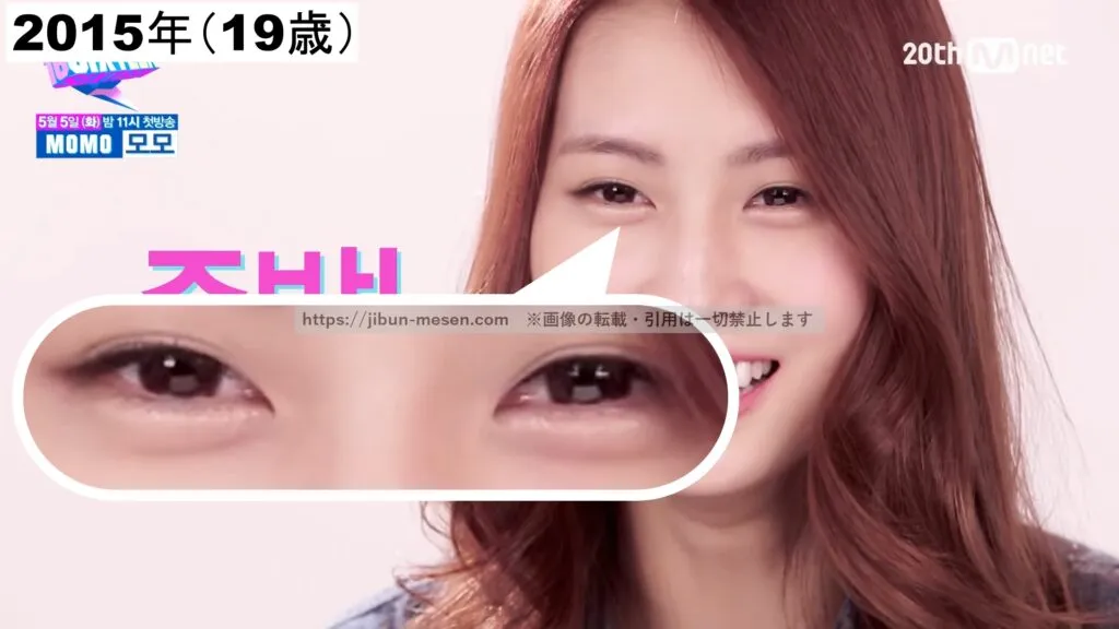 TWICEモモの二重まぶた(2015年)