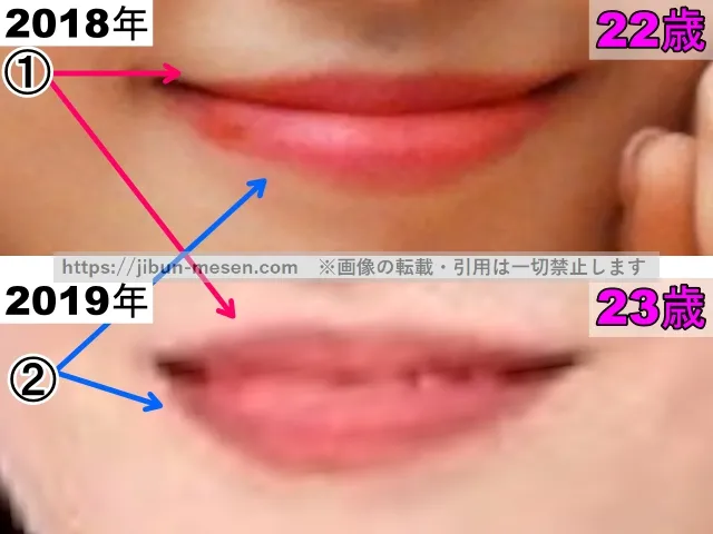 TWICEモモの唇の整形検証2018年〜2019年（拡大）