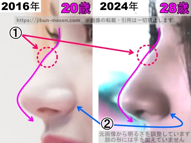 TWICEサナの鼻の整形検証2016年〜2024年(拡大)